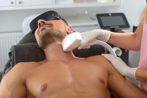 Laser Hair Removal